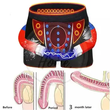 Oamenii Fiziologice Boxer Magnet Lenjerie de Îngrijire a Sănătății Funcție de Plasă Respirabil Terapie Magnet pantaloni Scurți pentru Bărbați Boxeri Energie pantaloni Scurți