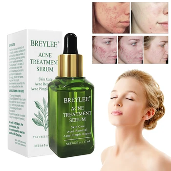 BREYLEE Acnee Tratament Ser Facial Anti Acnee Cicatrice Îndepărtarea Cremă de Albire Reparații Remover Cos de Îngrijire a Pielii TSLM2