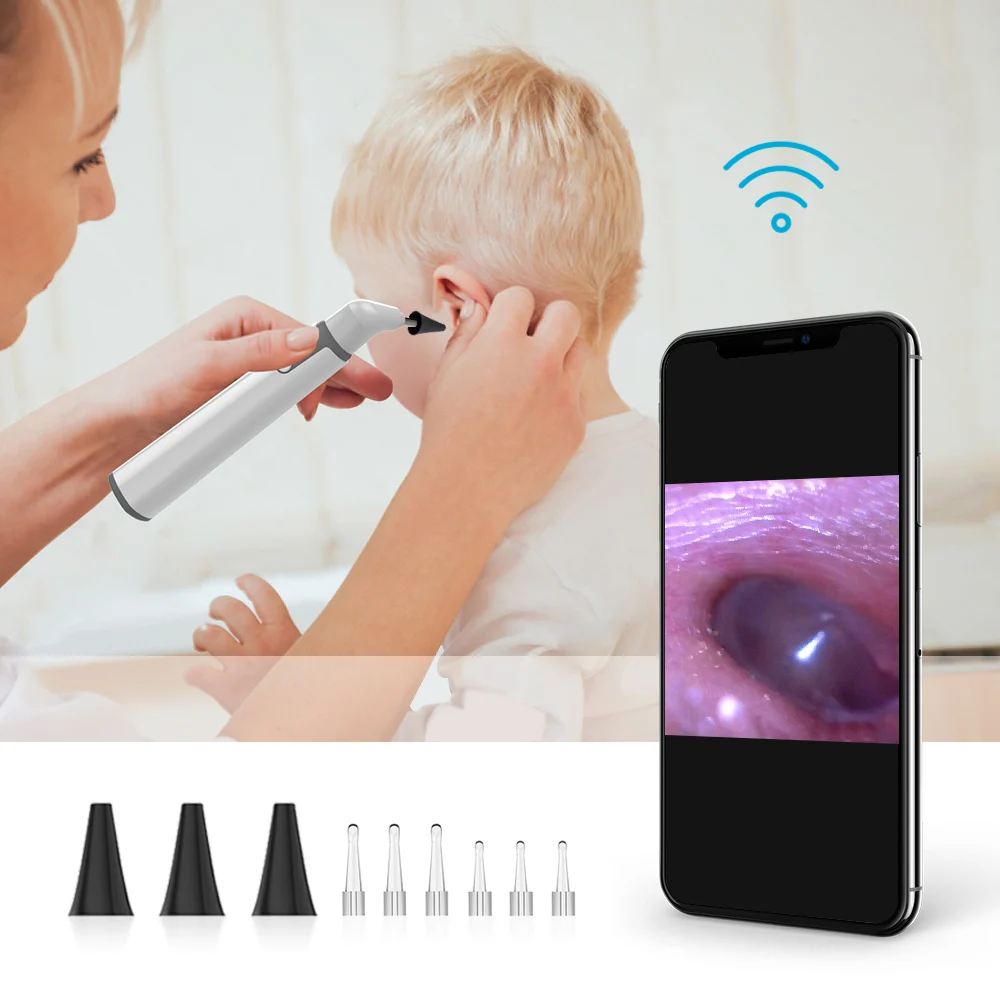 Otoscop Wifi Ureche 3.9 mm Smart Wireless Portabil Vizuale Cerumen Curățare Medicale Endoscop Camera pentru iPhone, Android Telefon 0.01 Imagine 1